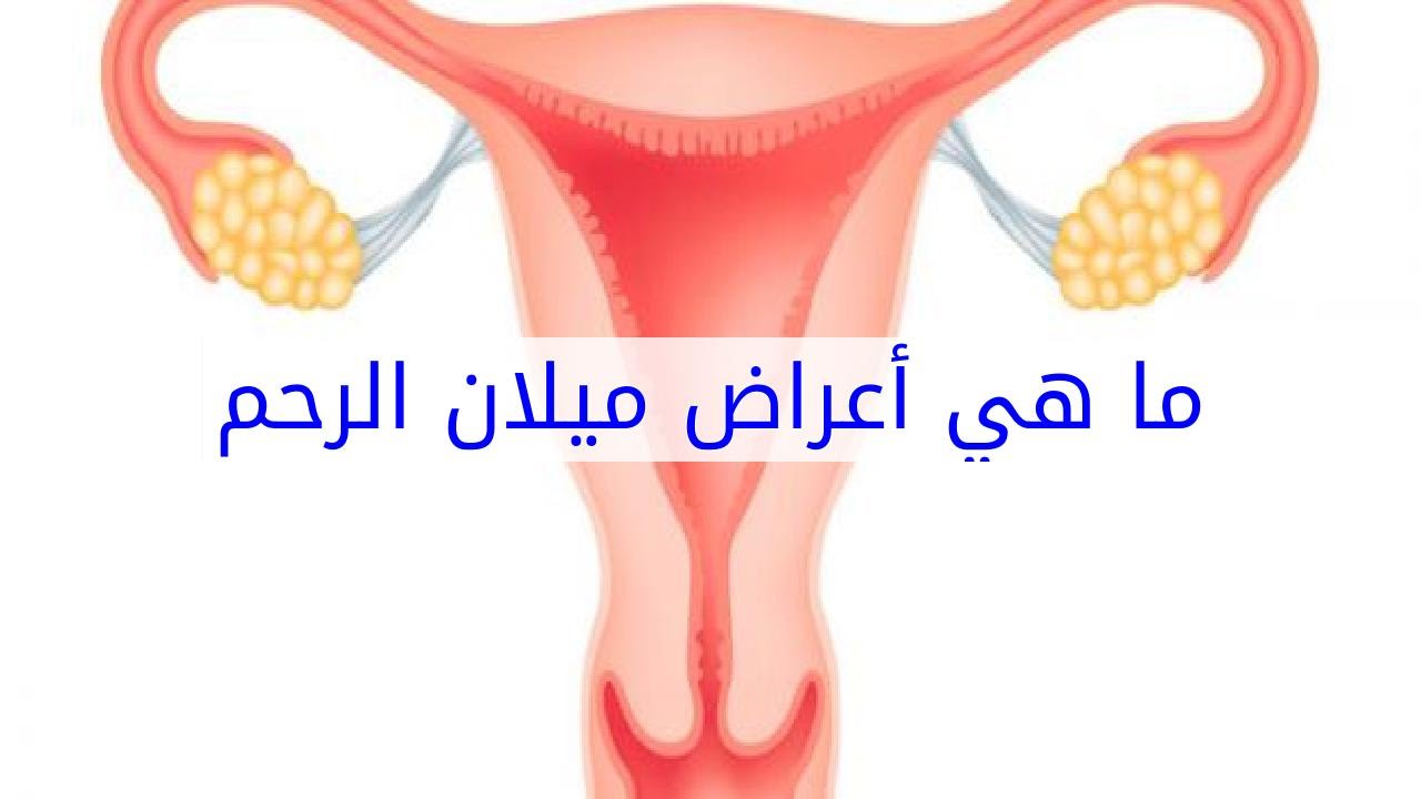 اعراض ميلان الرحم-تعرف على أعراض المرض اعراض ميلان الرحمتعرف على أعراض المرض