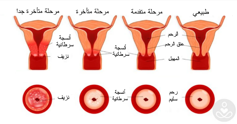 صور عنق الرحم - صور من داخل رحم المراه -D8-B5-D9-88-D8-B1 -D8-B9-D9-86-D9-82 -D8-A7-D9-84-D8-B1-D8-Ad-D9-85 -D8-B5-D9-88-D8-B1 -D9-85-D9-86 -D8-Af-D8-A7-D8-Ae-D9-84 -D8-B1-D8-Ad-D9-85 -D8-A7-D9-84-D9-85-D8-B1-D8-A7-D9-87 3