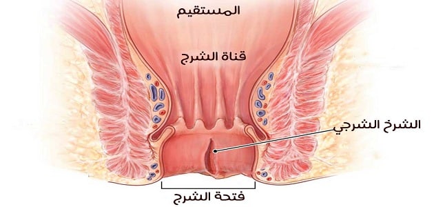 اعراض الشرخ البسيط , كيفية اصابة البواسير