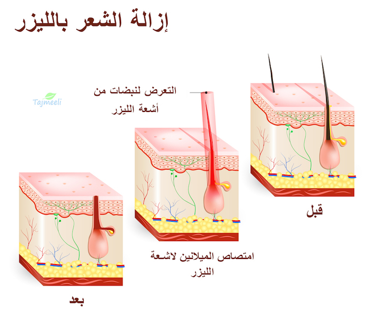 افضل طرق ازالة الشعر من المناطق الحساسة-اليك سيدتي احسن طرق آزالة الشعر -D8-A5-D8-B2-D8-A7-D9-84-D8-A9 -D8-B4-D8-B9-D8-B1 -D8-A7-D9-84-D9-85-D9-86-D8-A7-D8-B7-D9-82 -D8-A7-D9-84-D8-Ad-D8-B3-D8-A7-D8-B3-D8-A9 -D8-A8-D8-A7-D9-84-D9-84-D9-8A-D8-B2-D8-B1 1