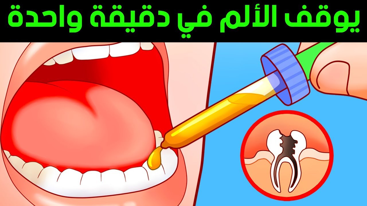 علاج الم الضرس المثقوب , الالام الضروس غير محتمله ولها علاج