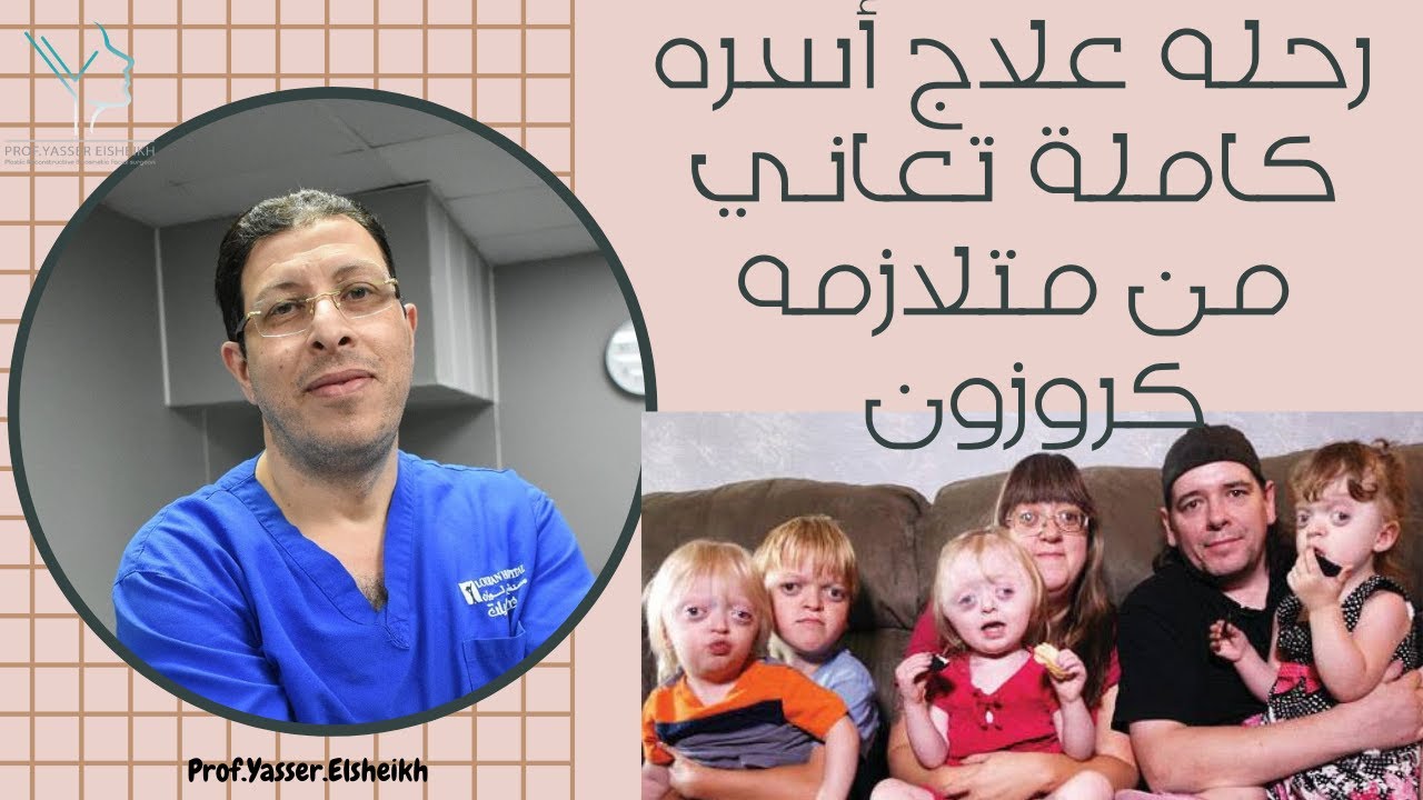 علاج متلازمة كروزون , العلاج بسيط بس المداومه