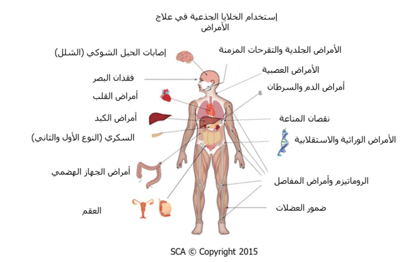 العلاج بالخلايا الجذعية - سبحان الله علاج سحري لبعض الامراض المستعصية العلاج بالخلايا الجذعية سبحان الله عل