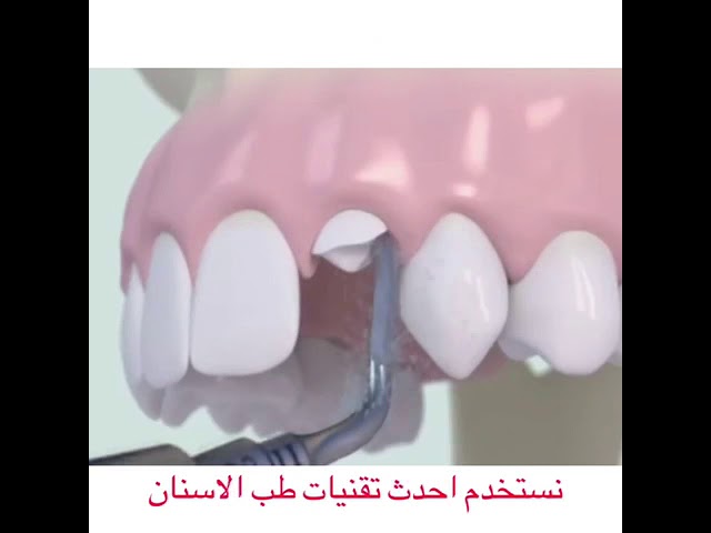 احدث تقنيات طب الاسنان - احدث التكنولوجيا والاجهزة احدث تقنيات طب الاسنان احدث التكنولوج