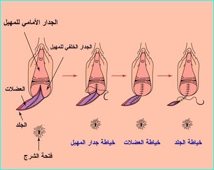 تضييق المهبل بالصور - بكل الطرق هتحصلي على مهبل ضيق -D8-Aa-D8-B6-D9-8A-D9-8A-D9-82 -D8-A7-D9-84-D9-85-D9-87-D8-A8-D9-84 -D8-A8-D8-A7-D9-84-D8-B5-D9-88-D8-B1 -D8-A8-D9-83-D9-84 -D8-A7-D9-84-D8-B7-D8-B1-D9-82 -D9-87-D8-Aa-D8-Ad-D8-B5-D9-84-D9-8A -D8-B9 5