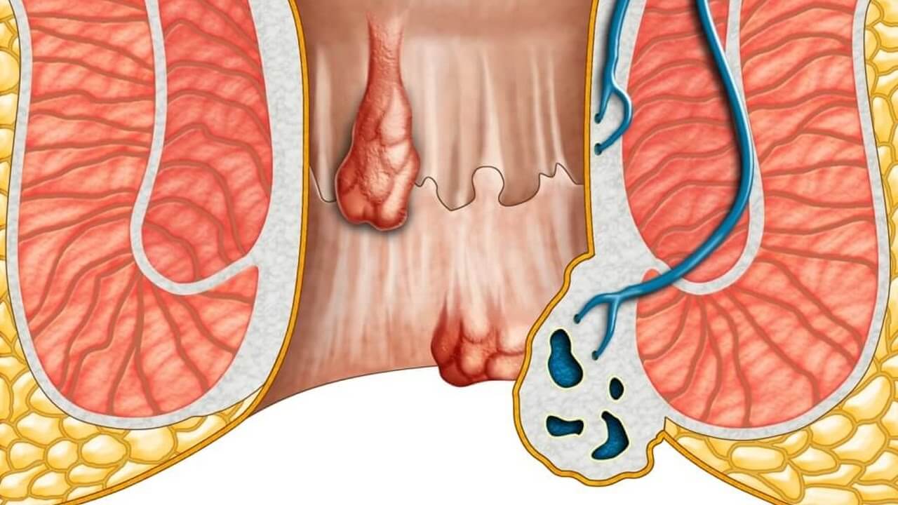 فتحة الدبر الطبيعية , مكان فتحة الشرج