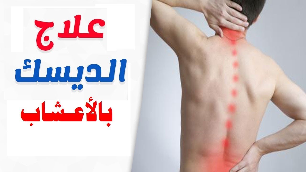 علاج دسك الرقبة بالاعشاب - التخلص من تشنج الرقبة -D8-B9-D9-84-D8-A7-D8-Ac -D8-Af-D8-B3-D9-83 -D8-A7-D9-84-D8-B1-D9-82-D8-A8-D8-A9 -D8-A8-D8-A7-D9-84-D8-A7-D8-B9-D8-B4-D8-A7-D8-A8