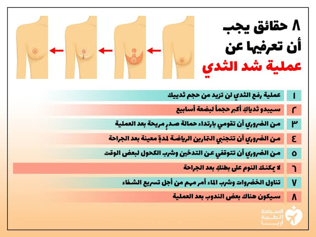 عملية شد الثدي - كيفيه عمليه شد الثدى Images 31 5