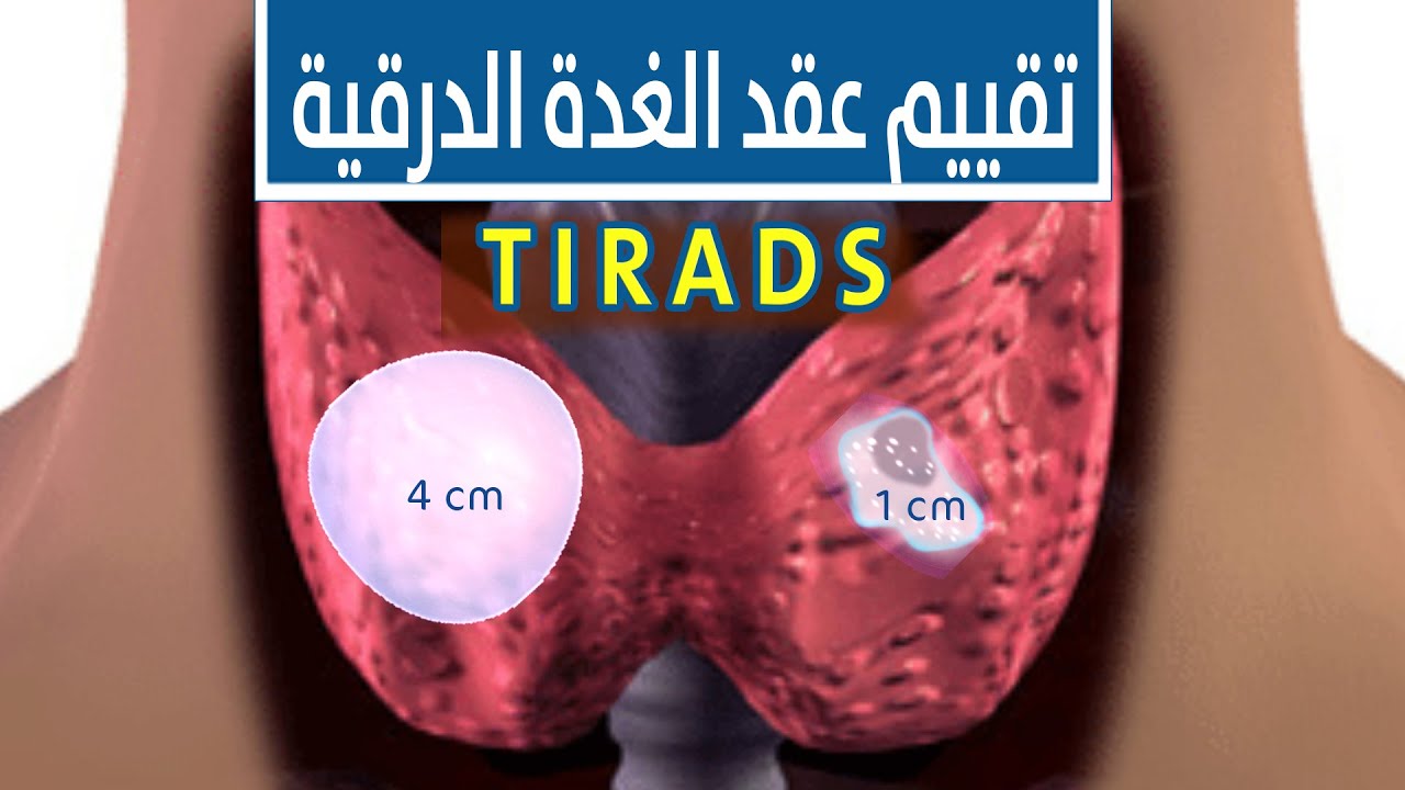 مين عملت مسح ذري او نووي على الغدة الدرقية , تدخل عسى ربي يجعل لها فرج من كل هم