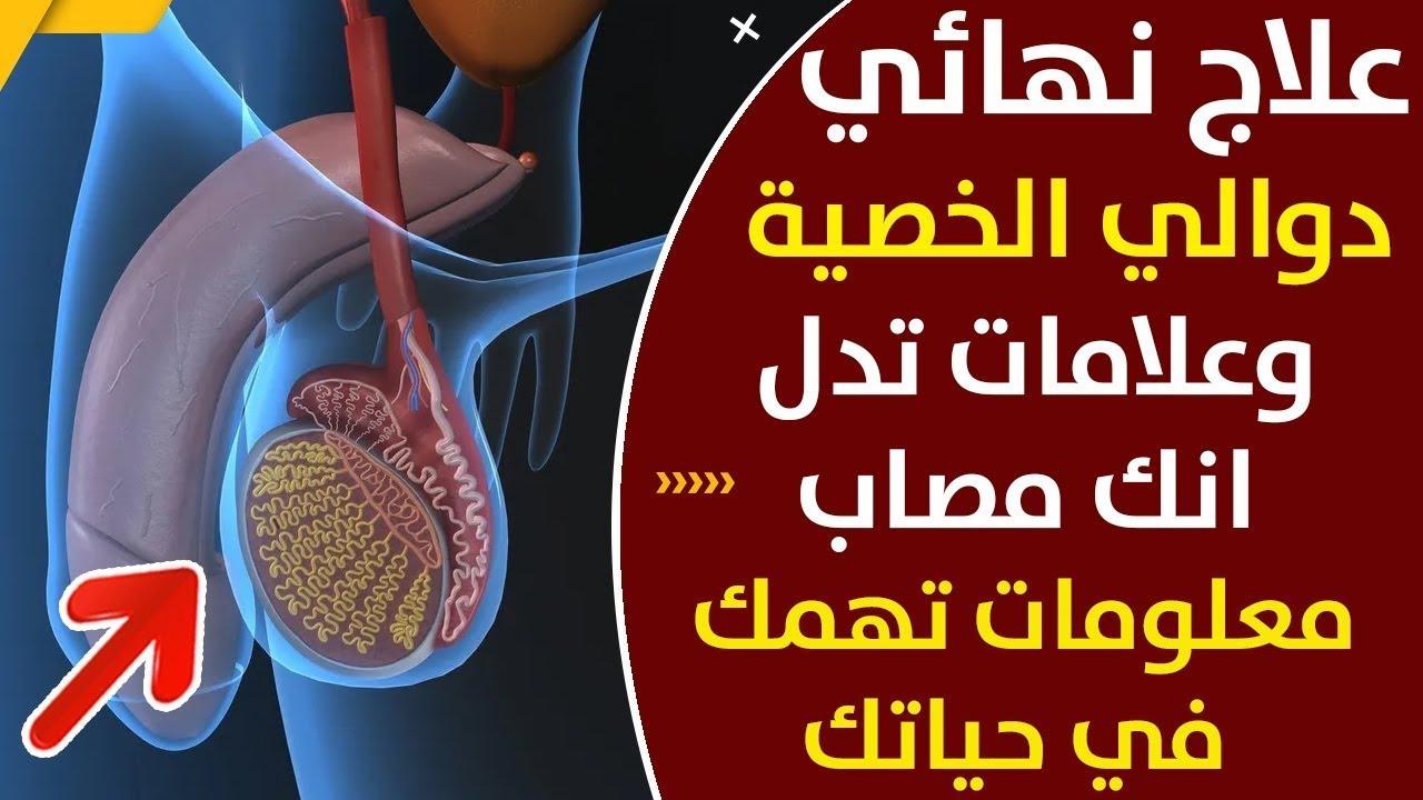 علاج دوالي الخصية بالصور - كيفيه التخلص من الدوالي واسبابها واعراضها علاج دوالي الخصية بالصور كيفيه التخلص