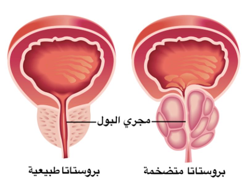 اين توجد البروستاتا , معلومات عن مكان البروستاتا في الجسم