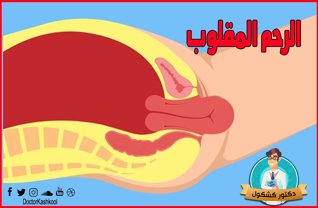 الرحم المقلوب بالصور - الاسباب المؤديه لهذه الحاله -D8-A7-D9-84-D8-B1-D8-Ad-D9-85 -D8-A7-D9-84-D9-85-D9-82-D9-84-D9-88-D8-A8 -D8-A8-D8-A7-D9-84-D8-B5-D9-88-D8-B1 -D8-A7-D9-84-D8-A7-D8-B3-D8-A8-D8-A7-D8-A8 -D8-A7-D9-84-D9-85-D8-A4-D8-Af-D9-8A-D9-87 4