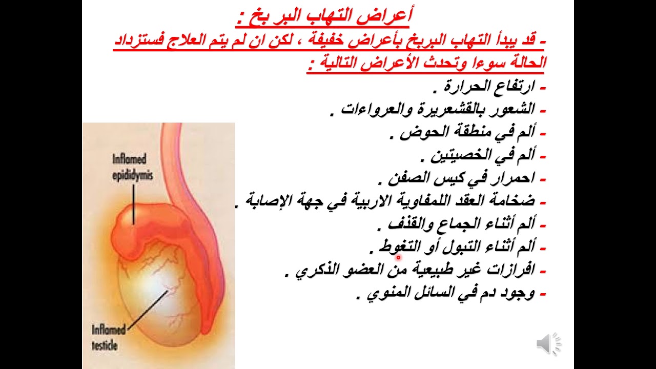 التهاب البربخ والعادة السرية-ليه بيحصل التهابات وتعب التهاب البربخ والعادة السريةليه بيحص