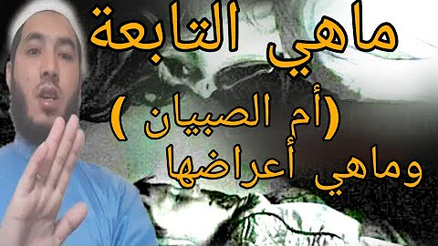 اعراض ام الصبيان عند الرجال- بتاخد الرجال بس اعراض ام الصبيان عند الرجال بتاخد الرج