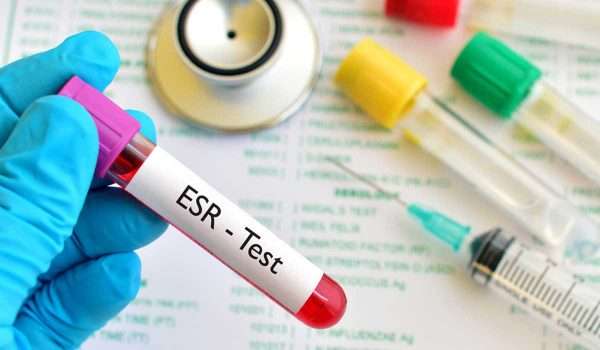 اعراض سرعة الترسيب - النتائج المترتبه على زياده نسبه Esr بالدم اعراض سرعة الترسيب النتائج المترتبه ع