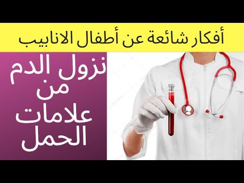 نزول دم في تاسع يوم من ترجيع الاجنة , اعرفى اسباب نزول الدم بعد ترجيع الأجنة