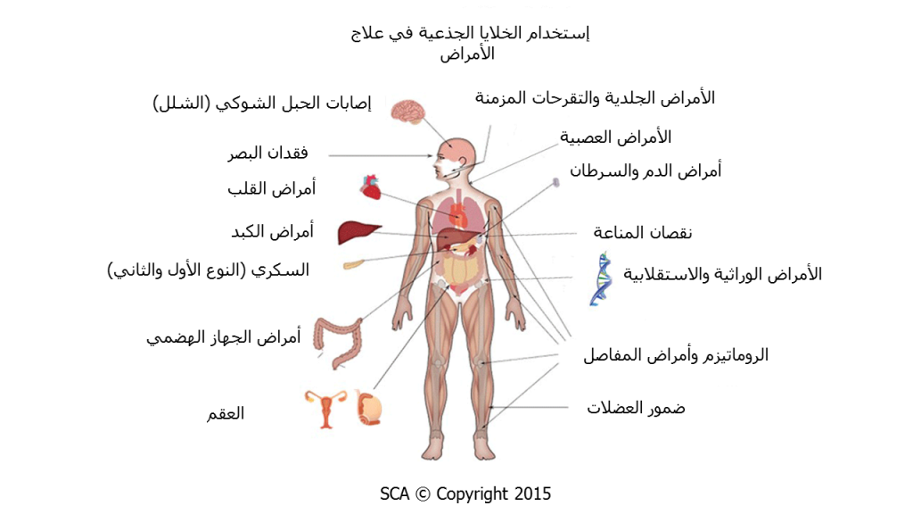 العلاج بالخلايا الجذعية - سبحان الله علاج سحري لبعض الامراض المستعصية -D8-A7-D9-84-D8-B9-D9-84-D8-A7-D8-Ac -D8-A8-D8-A7-D9-84-D8-Ae-D9-84-D8-A7-D9-8A-D8-A7 -D8-A7-D9-84-D8-Ac-D8-B0-D8-B9-D9-8A-D8-A9 -D8-B3-D8-A8-D8-Ad-D8-A7-D9-86 -D8-A7-D9-84-D9-84-D9-87 -D8-B9-D9-84