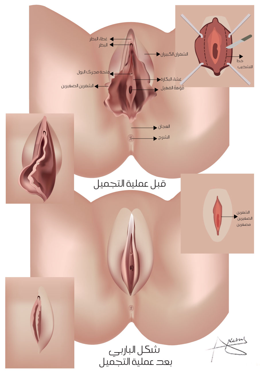 تضييق المهبل بالصور - بكل الطرق هتحصلي على مهبل ضيق -D8-Aa-D8-B6-D9-8A-D9-8A-D9-82 -D8-A7-D9-84-D9-85-D9-87-D8-A8-D9-84 -D8-A8-D8-A7-D9-84-D8-B5-D9-88-D8-B1 -D8-A8-D9-83-D9-84 -D8-A7-D9-84-D8-B7-D8-B1-D9-82 -D9-87-D8-Aa-D8-Ad-D8-B5-D9-84-D9-8A -D8-B9 2