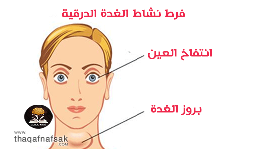 اعراض نقص نشاط الغدة الدرقية , معلومات عن الغدة الدرقية