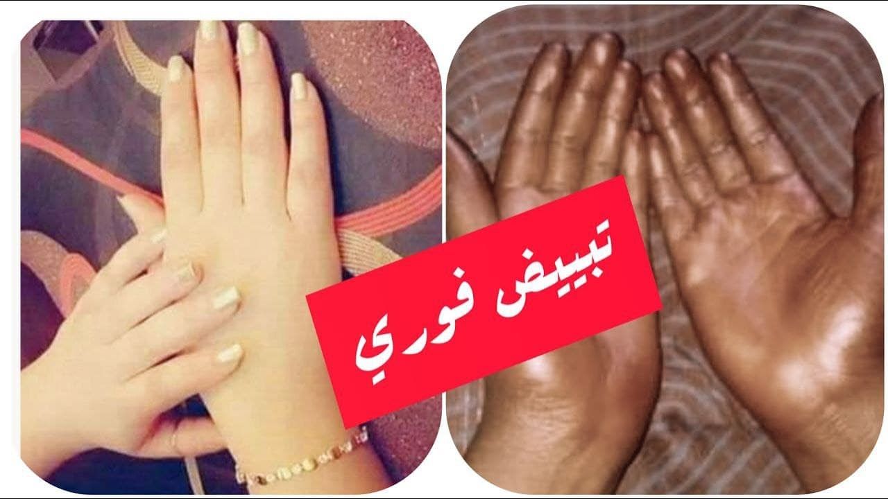 خلطه تجنن لليدين السمره والمفاصل السو 2