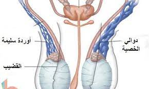 دوالي الخصية بالصور ، اسباب ظهور الدوالي -D8-Af-D9-88-D8-A7-D9-84-D9-8A -D8-A7-D9-84-D8-Ae-D8-B5-D9-8A-D8-A9 -D8-A8-D8-A7-D9-84-D8-B5-D9-88-D8-B1 -D8-8C -D8-A7-D8-B3-D8-A8-D8-A7-D8-A8 -D8-B8-D9-87-D9-88-D8-B1 -D8-A7-D9-84-D8-Af-D9-88-D8-A7 6