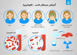 اعراض سرطان القلب , تعرفى على اعراض سرطان القلب