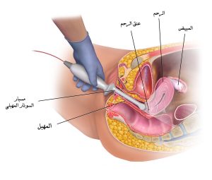 كيفية تضييق المهبل بعد الولادة الطبيعية , ابسط خطوات تضييق المهبل فى المنزل