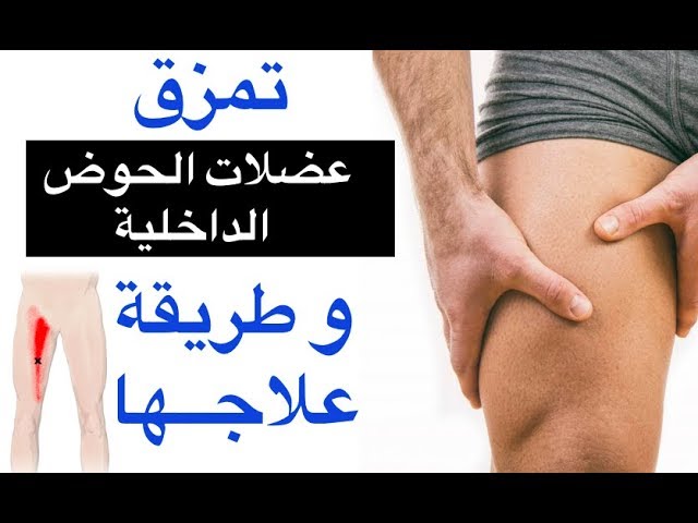 علاج تمزق العضلات - ما السبب في تمزق العضله علاج تمزق العضلات ما السبب في تمزق الع