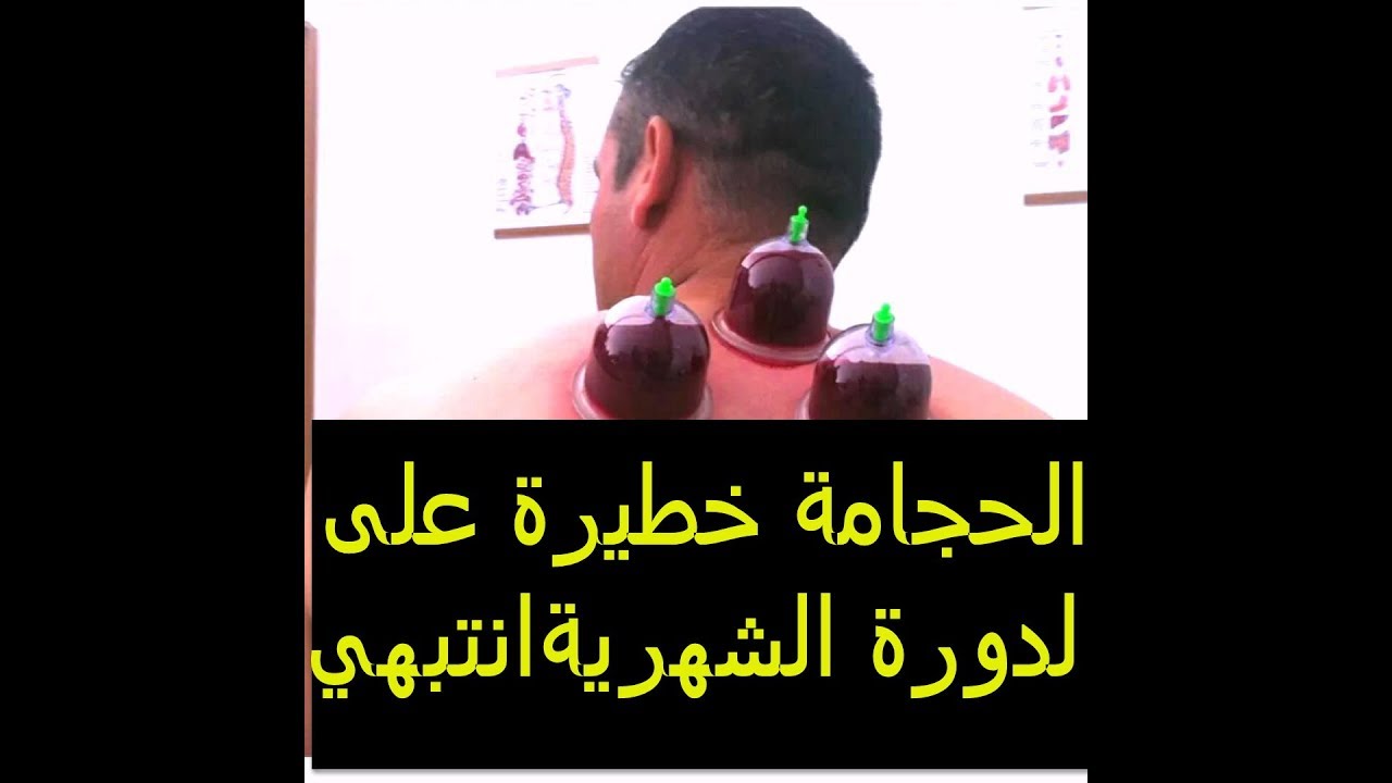 الحجامه وقت الدوره معلومه خطيره جدا- كلمه عن الحجامه ومخاطرها الحجامه وقت الدوره معلومه خطيره جداكل