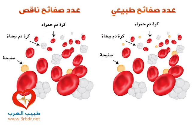 نسبة الصفائح الدموية الطبيعية في الجسم , هل تعلم عن نسبة الصفايح