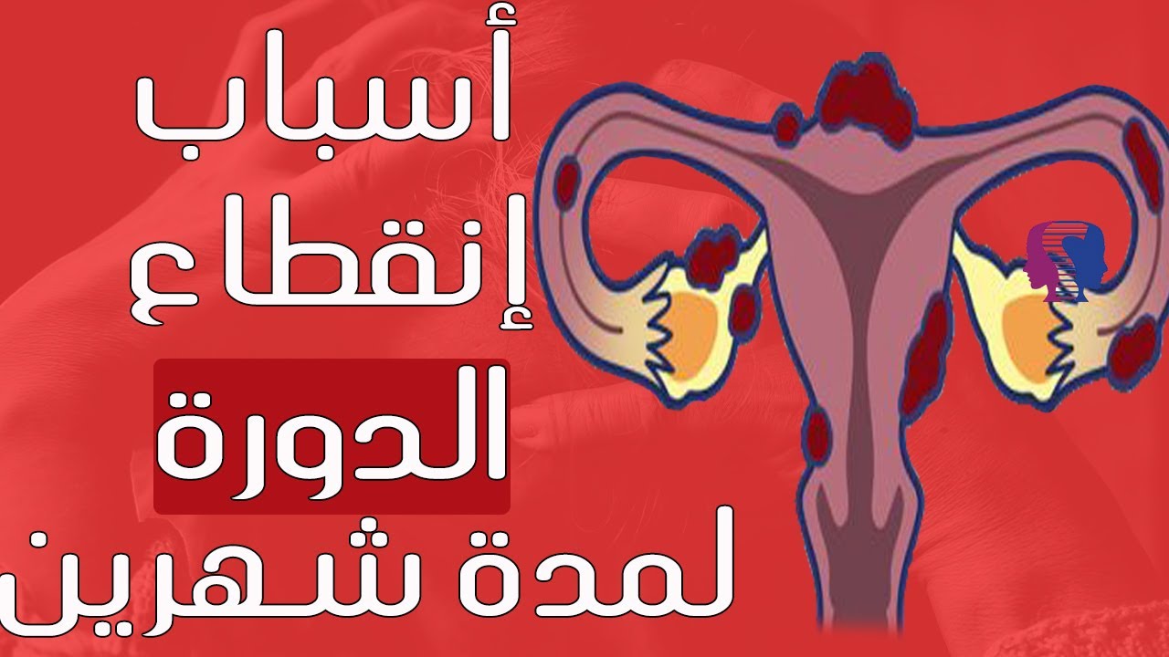 علاج تاخر الدورة الشهرية لمدة شهرين-لازم تعرفى السبب علاج تاخر الدورة الشهرية لمدة شهرينلا