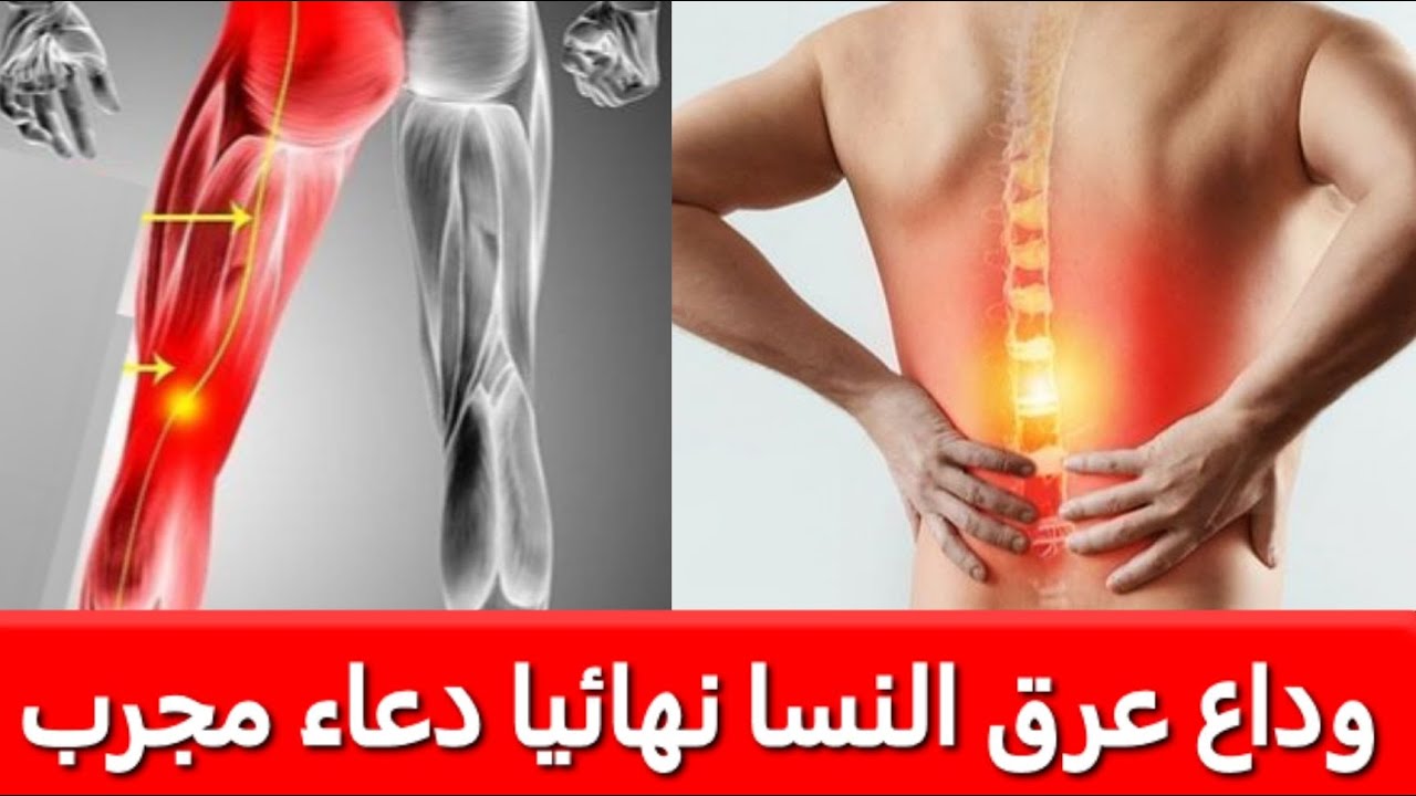 دعاء لعلاج عرق النسا - اعظم الادعية للشفاء باذن الله -D8-Af-D8-B9-D8-A7-D8-A1 -D9-84-D8-B9-D9-84-D8-A7-D8-Ac -D8-B9-D8-B1-D9-82 -D8-A7-D9-84-D9-86-D8-B3-D8-A7 -D8-A7-D8-B9-D8-B8-D9-85 -D8-A7-D9-84-D8-A7-D8-Af-D8-B9-D9-8A-D8-A9 -D9-84-D9-84-D8-B4-D9-81 1