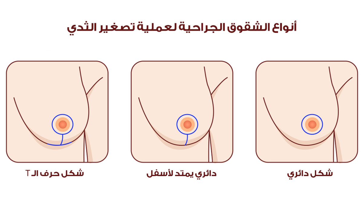 رياضة لتصغير الثدي- تمارين سهله وفعاله لتصغير الثدي -D8-B1-D9-8A-D8-A7-D8-B6-D8-A9 -D9-84-D8-Aa-D8-B5-D8-Ba-D9-8A-D8-B1 -D8-A7-D9-84-D8-Ab-D8-Af-D9-8A -D8-Aa-D9-85-D8-A7-D8-B1-D9-8A-D9-86 -D8-B3-D9-87-D9-84-D9-87 -D9-88-D9-81-D8-B9-D8-A7-D9-84-D9-87 9