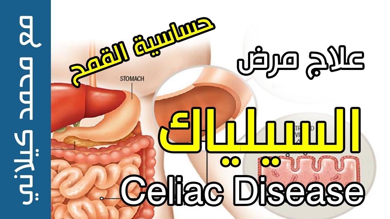 علاج مرض السيلياك , أقوى علاجات للمرض دا