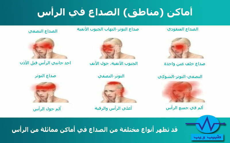 اماكن الصداع واسبابها - آلآم الرأس بأنواعها ومسبباتها -D8-A7-D9-85-D8-A7-D9-83-D9-86 -D8-A7-D9-84-D8-B5-D8-Af-D8-A7-D8-B9 -D9-88-D8-A7-D8-B3-D8-A8-D8-A7-D8-A8-D9-87-D8-A7 -D8-A2-D9-84-D8-A2-D9-85 -D8-A7-D9-84-D8-B1-D8-A3-D8-B3 -D8-A8-D8-A3-D9-86-D9-88