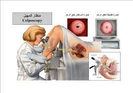 بنات سر زميلتي المسحات الطبيه ، تجربتي للمسحة الطبية -D8-A8-D9-86-D8-A7-D8-Aa -D8-B3-D8-B1 -D8-B2-D9-85-D9-8A-D9-84-D8-Aa-D9-8A -D8-A7-D9-84-D9-85-D8-B3-D8-Ad-D8-A7-D8-Aa -D8-A7-D9-84-D8-B7-D8-A8-D9-8A-D9-87 -D8-8C -D8-Aa-D8-Ac-D8-B1-D8-A8-D8-Aa-D9-8A