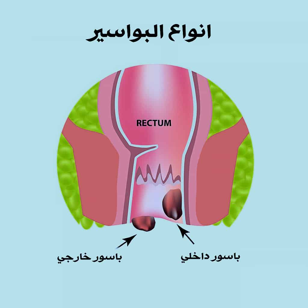 فتحة الدبر الطبيعية - مكان فتحة الشرج -D9-81-D8-Aa-D8-Ad-D8-A9 -D8-A7-D9-84-D8-Af-D8-A8-D8-B1 -D8-A7-D9-84-D8-B7-D8-A8-D9-8A-D8-B9-D9-8A-D8-A9 -D9-85-D9-83-D8-A7-D9-86 -D9-81-D8-Aa-D8-Ad-D8-A9 -D8-A7-D9-84-D8-B4-D8-B1-D8-Ac 2