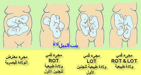 لاحلى حوامل التوائم-ابتكارات لكل حامل فى توائم -D9-84-D8-A7-D8-Ad-D9-84-D9-89 -D8-Ad-D9-88-D8-A7-D9-85-D9-84 -D8-A7-D9-84-D8-Aa-D9-88-D8-A7-D8-A6-D9-85-D8-A7-D8-A8-D8-Aa-D9-83-D8-A7-D8-B1-D8-A7-D8-Aa -D9-84-D9-83-D9-84 -D8-Ad-D8-A7-D9-85-D9-84 2