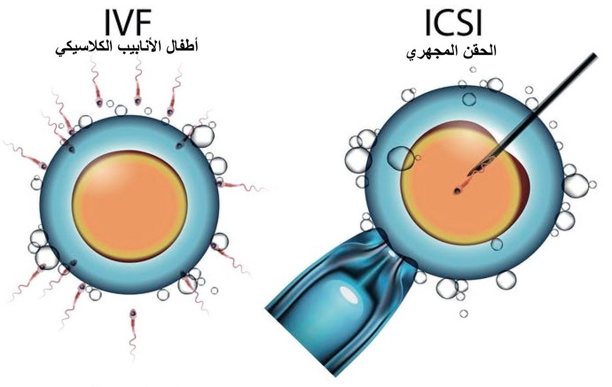 للمقدمات والمنتظرات نتيجة اطفال الانابيب والحقن المجهري - افضل طرق لعمليات اطفال الانابيب -D9-84-D9-84-D9-85-D9-82-D8-Af-D9-85-D8-A7-D8-Aa -D9-88-D8-A7-D9-84-D9-85-D9-86-D8-Aa-D8-B8-D8-B1-D8-A7-D8-Aa -D9-86-D8-Aa-D9-8A-D8-Ac-D8-A9 -D8-A7-D8-B7-D9-81-D8-A7-D9-84 -D8-A7-D9-84-D8-A7-D9-86 2