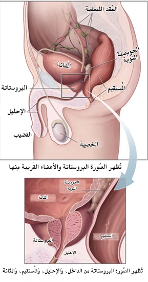 اعراض التهاب البروستات , كل اللى فوق ال60