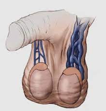دوالي الخصية والحمل ، كيف اتخلص منها دوالي الخصية والحمل ، كيف اتخلص منها